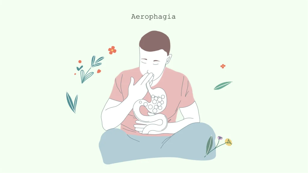 aerophagia