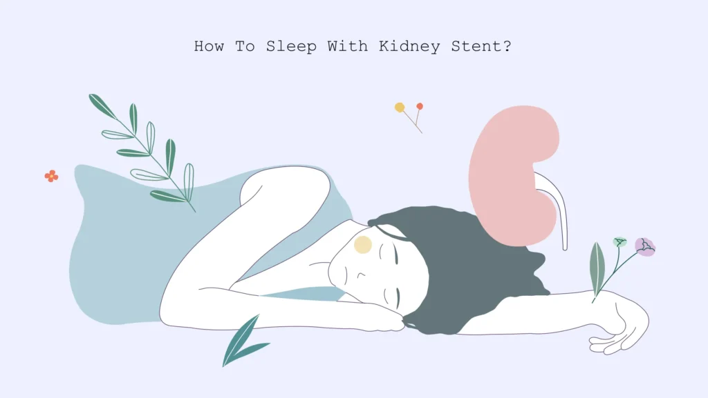 how to sleep with a kidney stent
